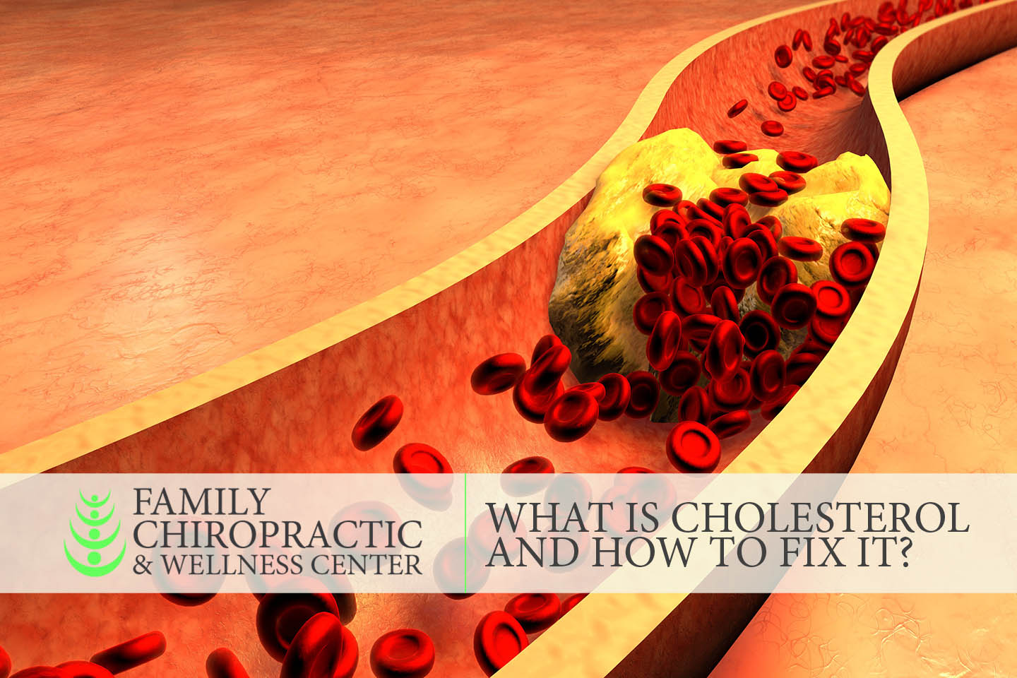 What is cholesterol and how to fix it? – Family Chiropractic & Wellness ...